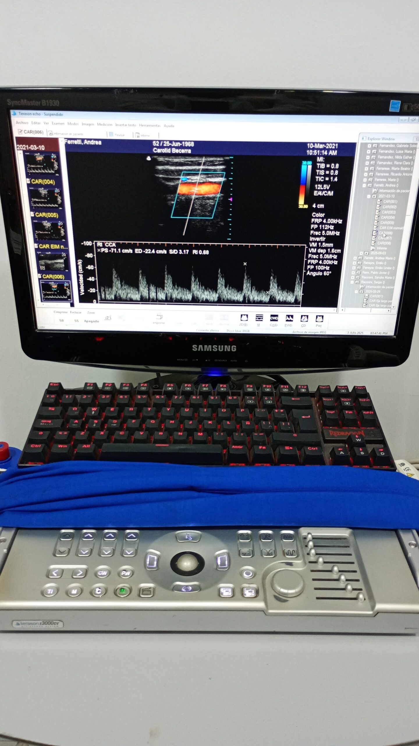 Ecografo Cardio Vascular